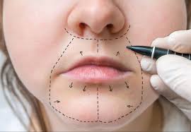 ปากไม่เท่ากันแก้ได้ไหม