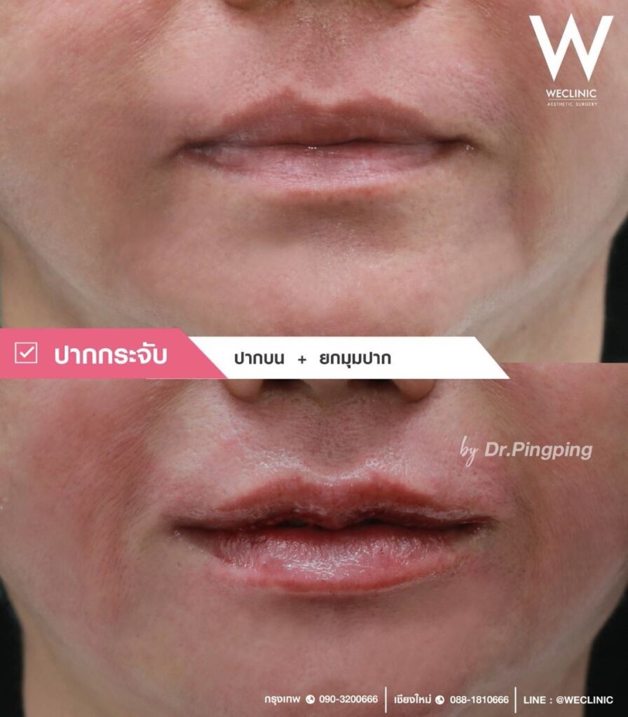 โหงวเฮ้งปากที่ดี