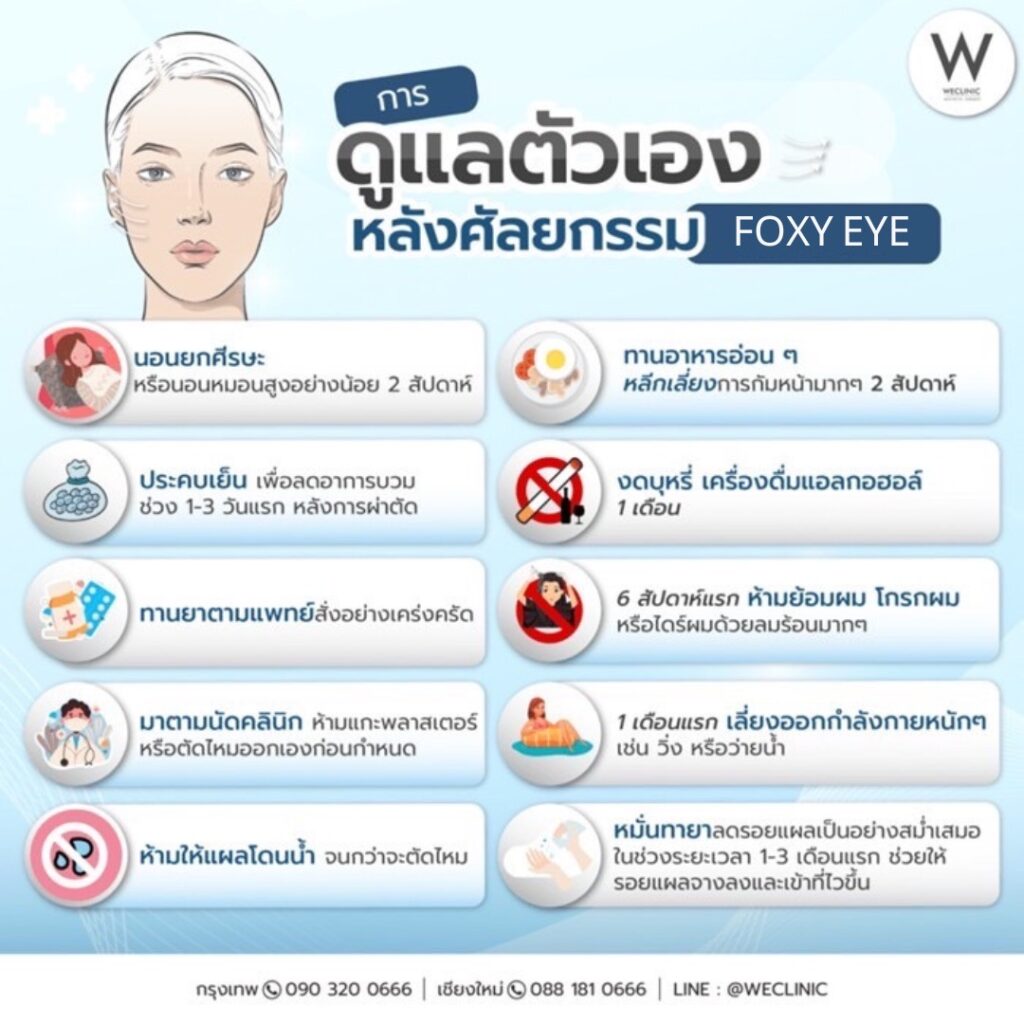 การดูแลตัวเองหลังศัลยกรรม foxy eye