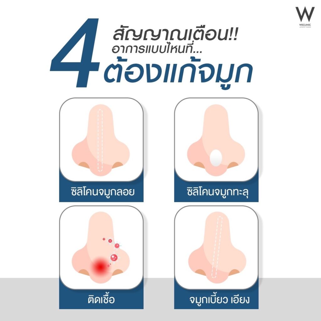 สาเหตุที่ต้องถอดซิลิโคนจมูก