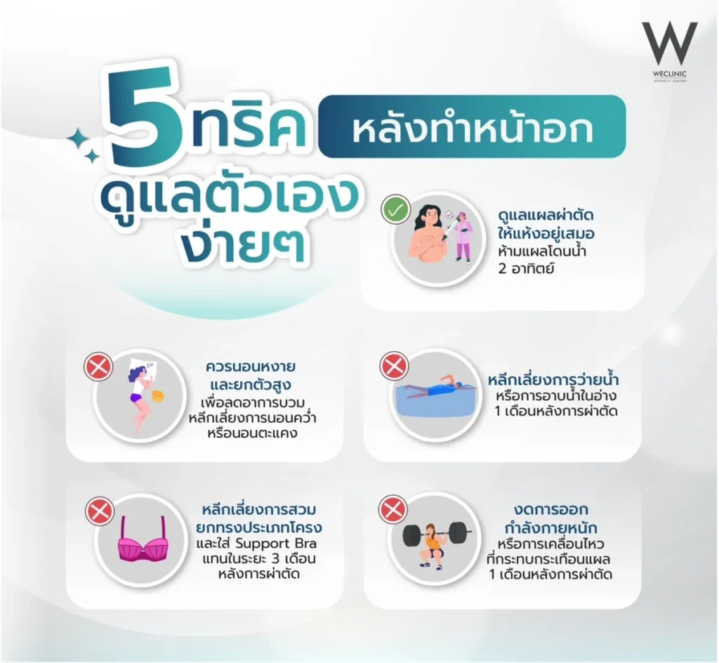 breast-augmentation-aftercare-5-tips
