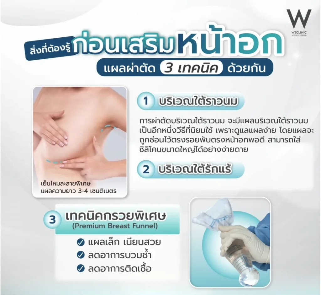 breast-augmentation-incision-techniques