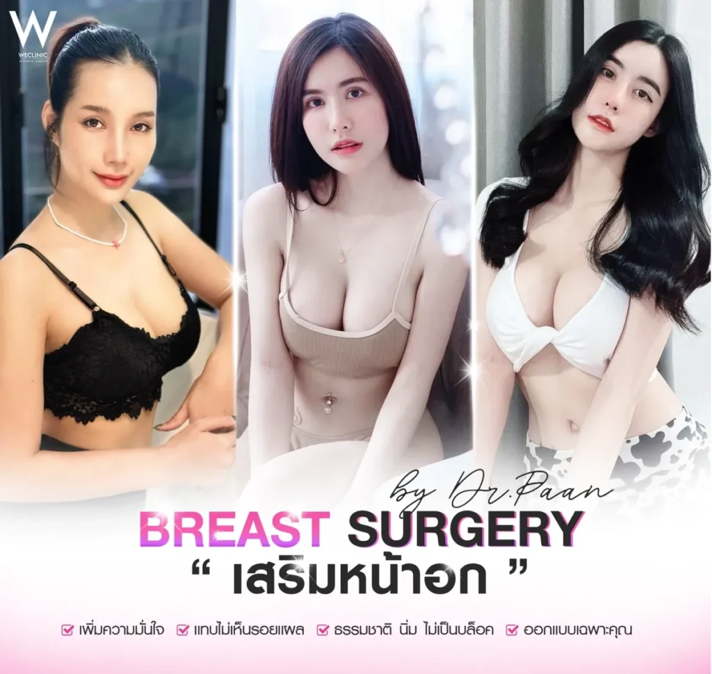 breast-augmentation-results-collage