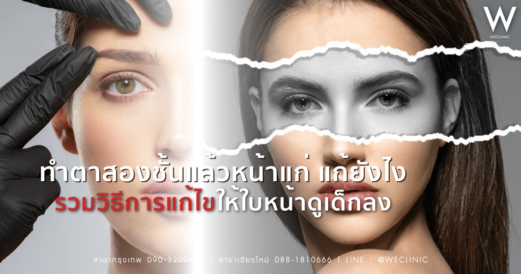 ทำตาสองชั้นแล้วหน้าแก่แก้ยังไง ค้นหาสาเหตุที่ทำให้หน้าดูแก่ขึ้น