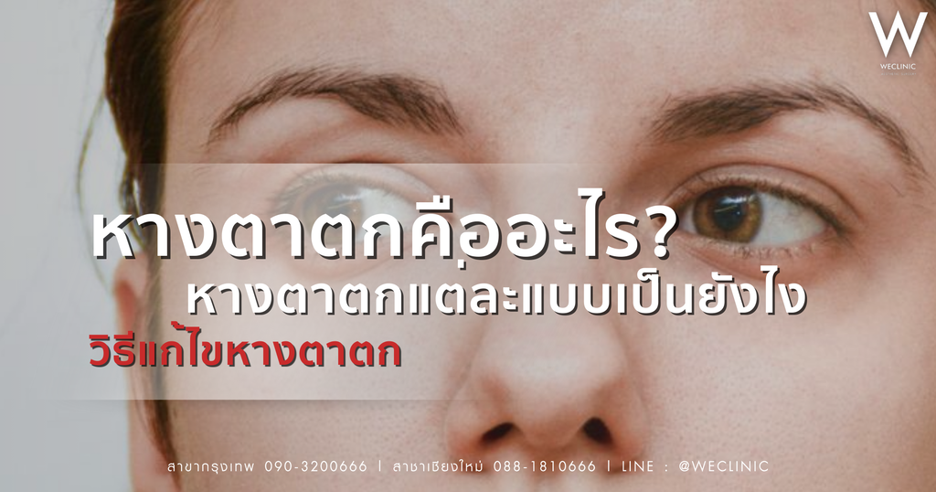 หางตาตกคืออะไร ? สาเหตุของหางตาตก และวิธีแก้ไขเมื่อหางตาตก