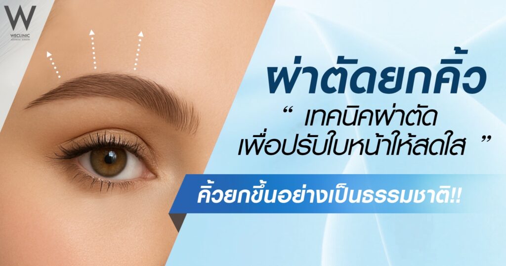 ผ่าตัดยกคิ้ว เทคนิคผ่าตัดเพื่อปรับใบหน้าให้สดใส