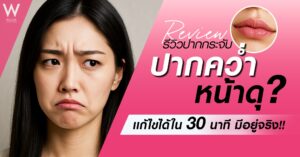 รีวิวปากกระจับ แก้ปากคว่ำ