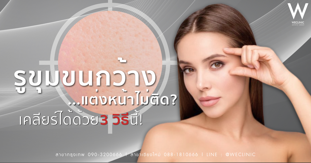 รูขุมขนกว้าง ทำไงดี? วิธีเคลียร์ผิวเนียนใส