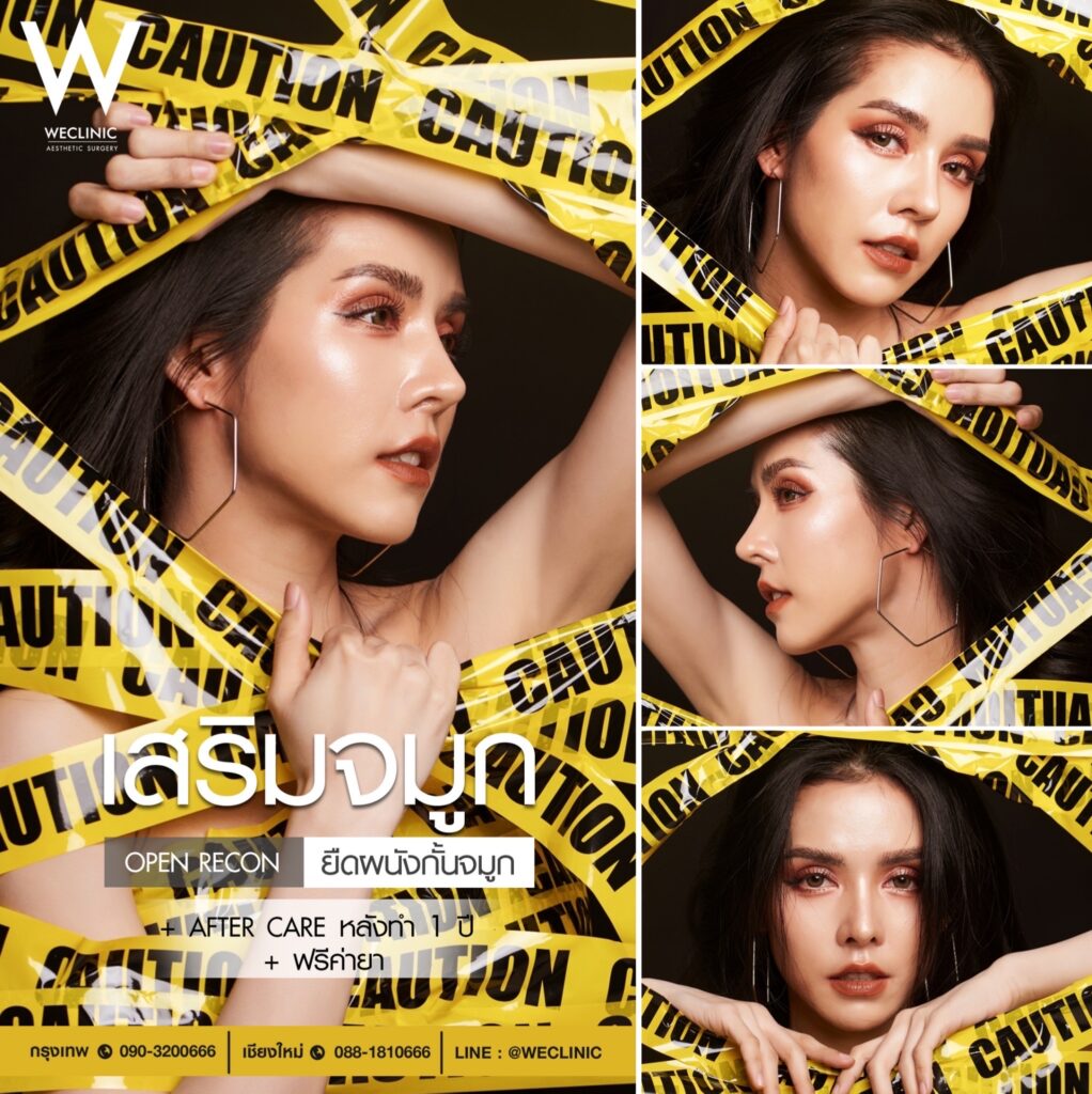 เสริมจมูกทรงตุรกี ที่ไหนดี