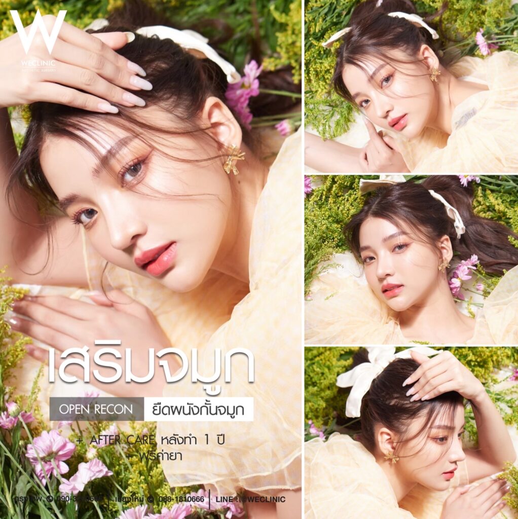 เสริมจมูกทรงใบเฟิร์น ราคาเท่าไร
