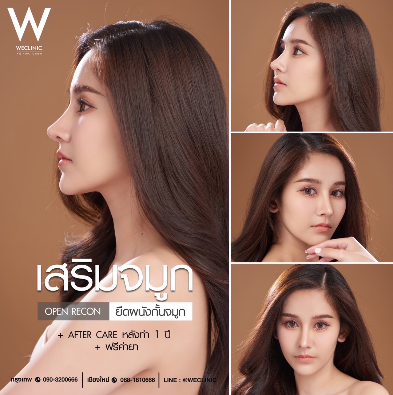 รีวิวจมูกทรงสโลปปลายพุ่ง