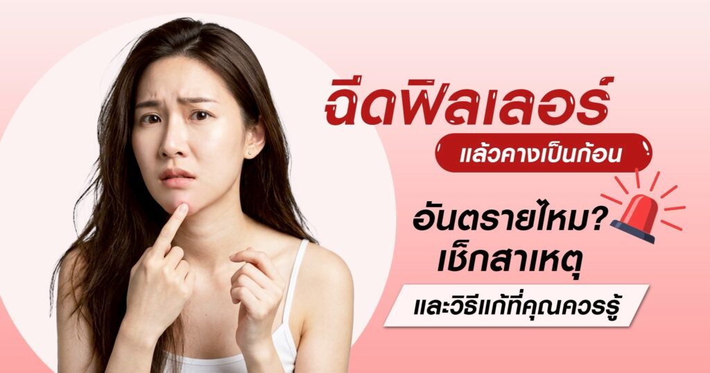 ฉีดฟิลเลอร์แล้วคางเป็นก้อน สาเหตุ อาการ วิธีแก้ไข