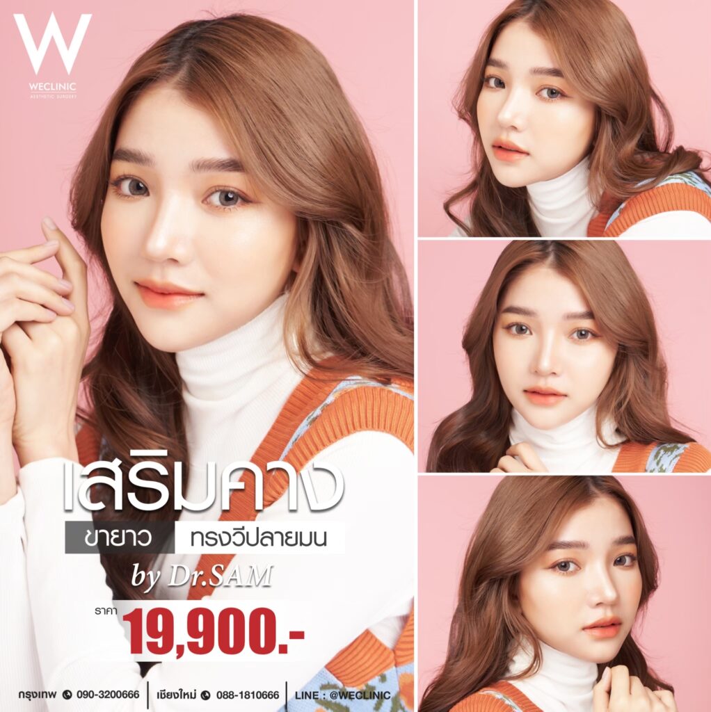 คางยื่นมีกี่ประเภท