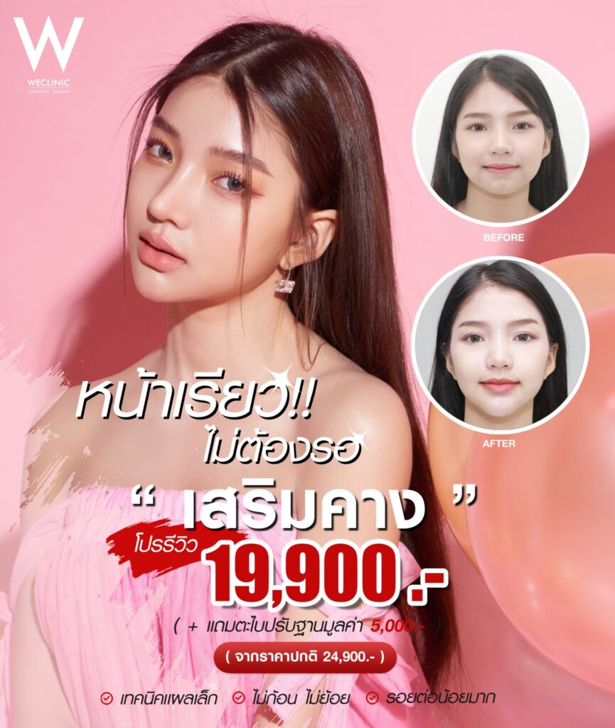 สัญญาณเช็กคางยื่น