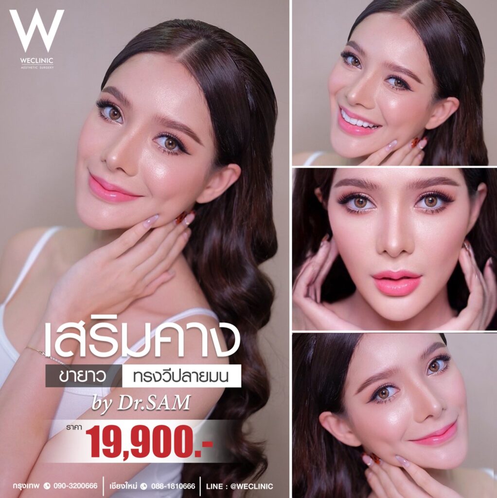 การเตรียมตัวก่อนแก้ไขคางยื่น