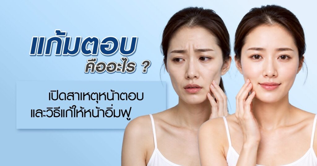 แก้มตอบ คืออะไร