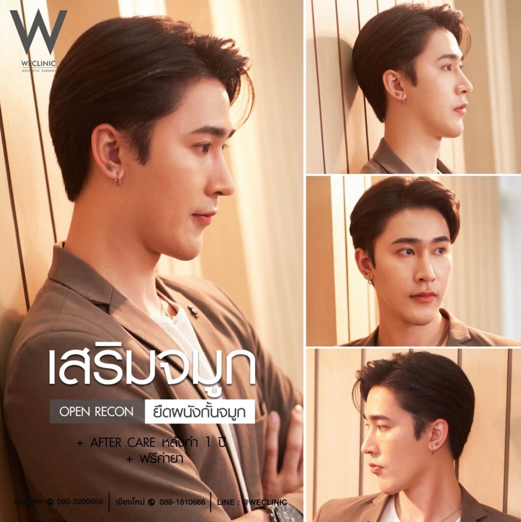 รีวิวทำจมูกผู้ชายกับคลินิกศัลยกรรม