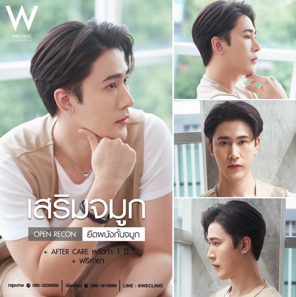 รวมรีวิวทำจมูกผู้ขาย