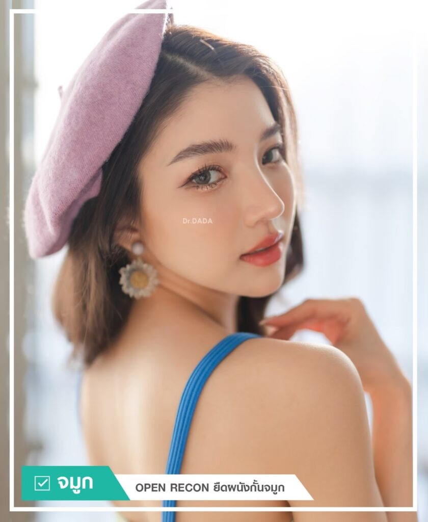 ทรงจมูกสำหรับคนหน้ากลม หน้าสั้น