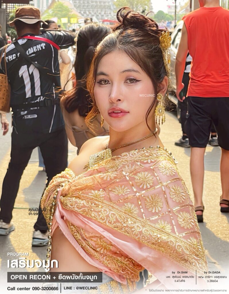 รีวิวเคสเสริมจมูก ทำดั้ง ที่ We Clinic