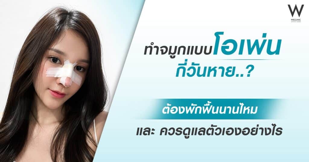 ทำจมูกแบบโอเพ่น กี่วันหาย