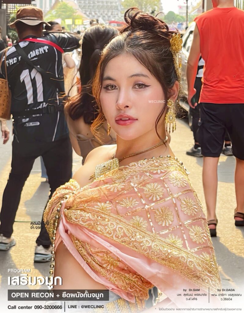 ปรับโครงสร้างจมูกโอเพ่น_ป๊อปปี้