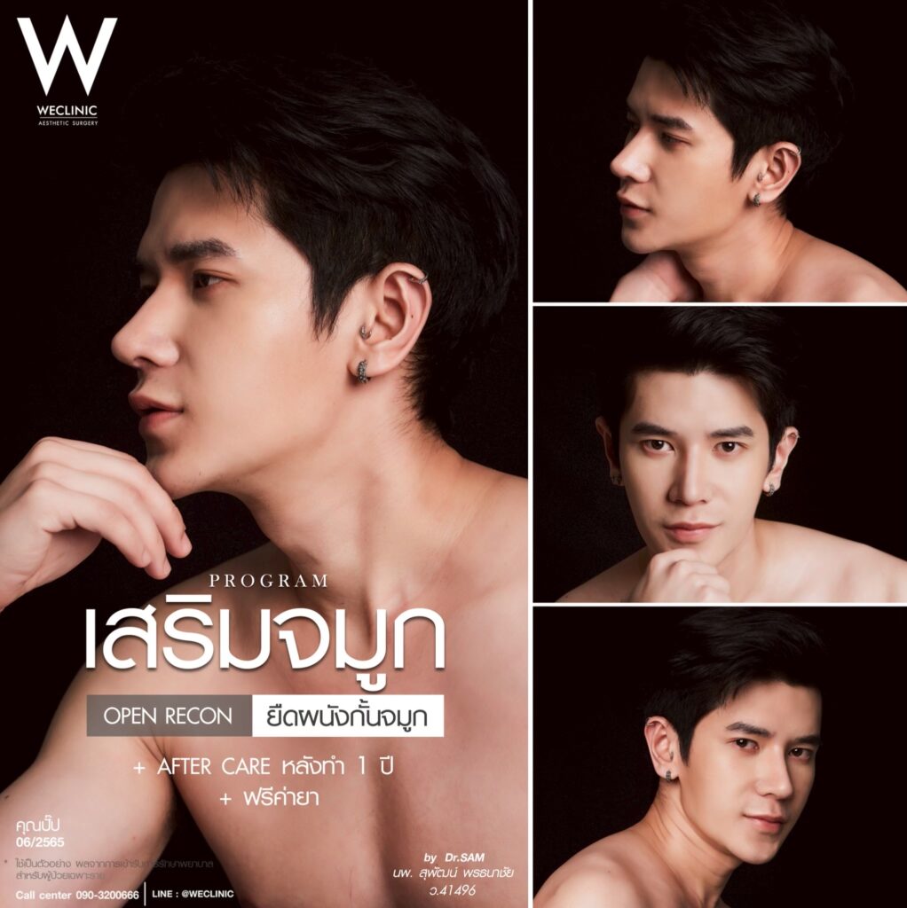 ทำจมูกผู้ชายโอเพ่น_ปั๊ป
