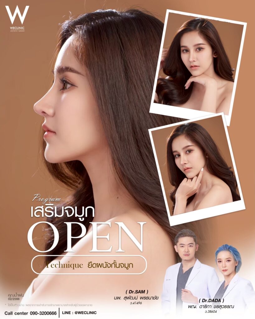 ผ่าตัดเสริมจมูกแบบ Open_น้ำฝน