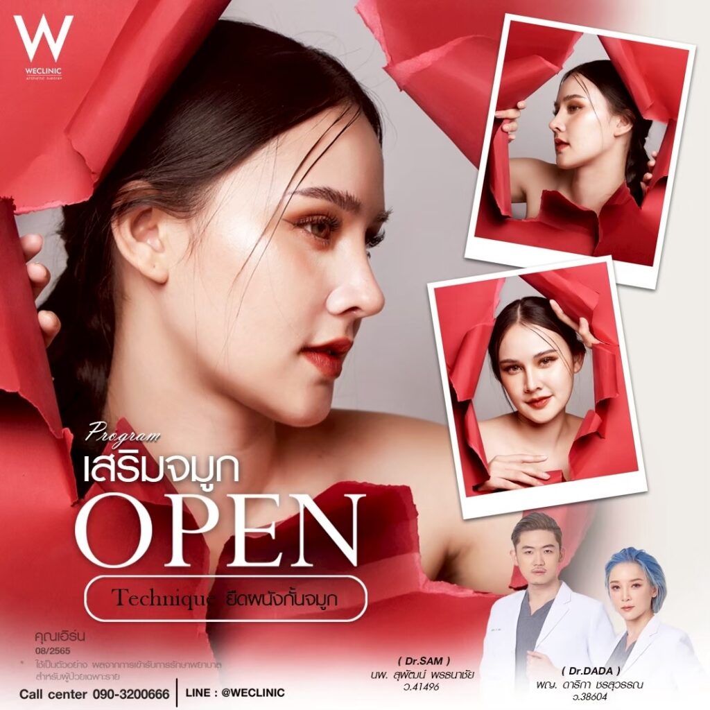 รีวิวเสริมจมูก_เอิร์น