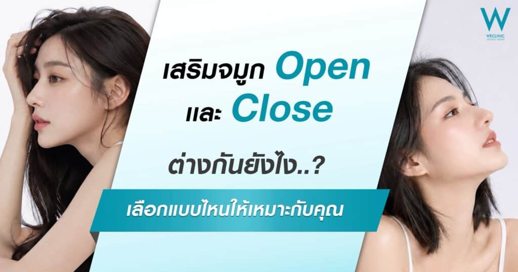 เสริมจมูก open กับ close ต่างกันอย่างไร