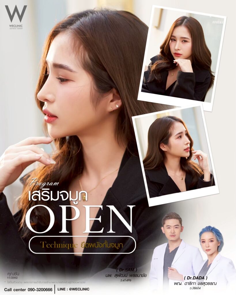 เสริมจมูกเทคนิคโอเพ่น_คุณซัน