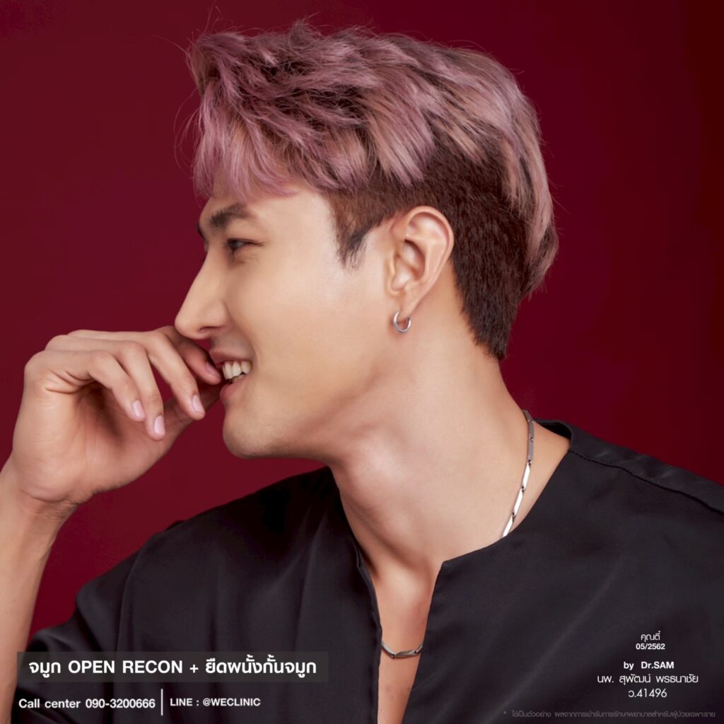 เสริมจมูกผู้ชาย Open Recon_ตี๋