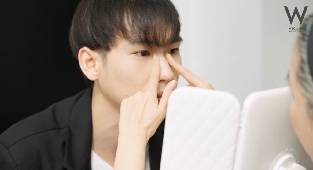 แผลจมูกกี่วันแห้ง