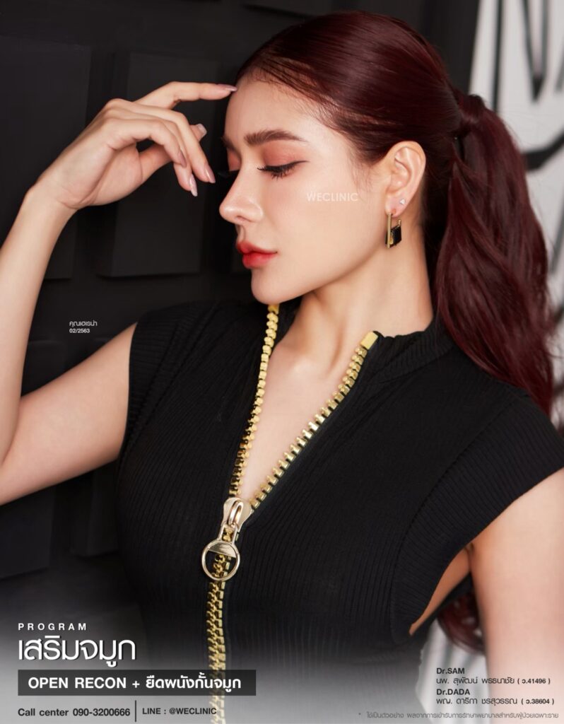 รีวิวทำจมูกไม่เท่ากัน_เฮเรน่า_หมอแซม_หมอดาด้า