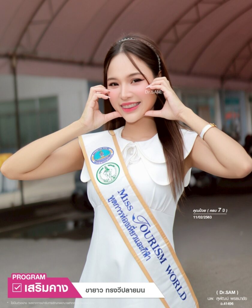 รีวิวเสริมคาง BKK_คุณป๋วย_หมอแซม