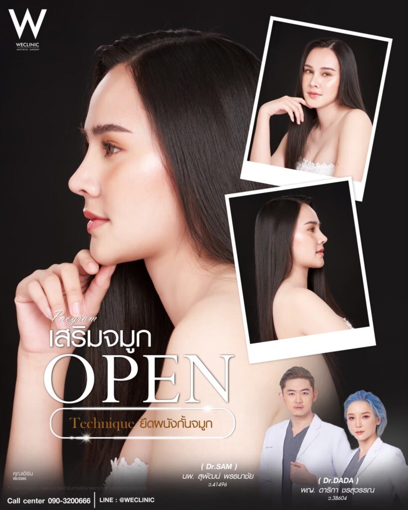 รีวิวเสริมจมูก Open_เอิร์น_หมอดาด้า_หมอแซม