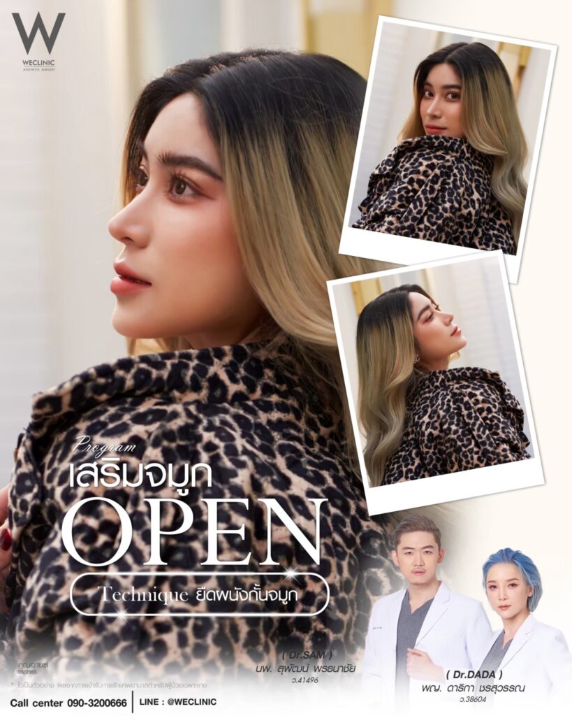 รีวิวเสริมจมูกเหยี่ยว_อายส์_หมอแซม_หมอดาด้า