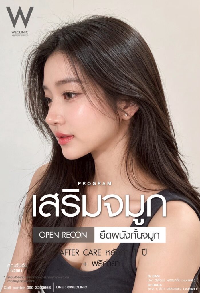 รีวิวเสริมจมูกโอเพ่น รีคอน_อันอัน_หมอดาด้า_หมอแซม