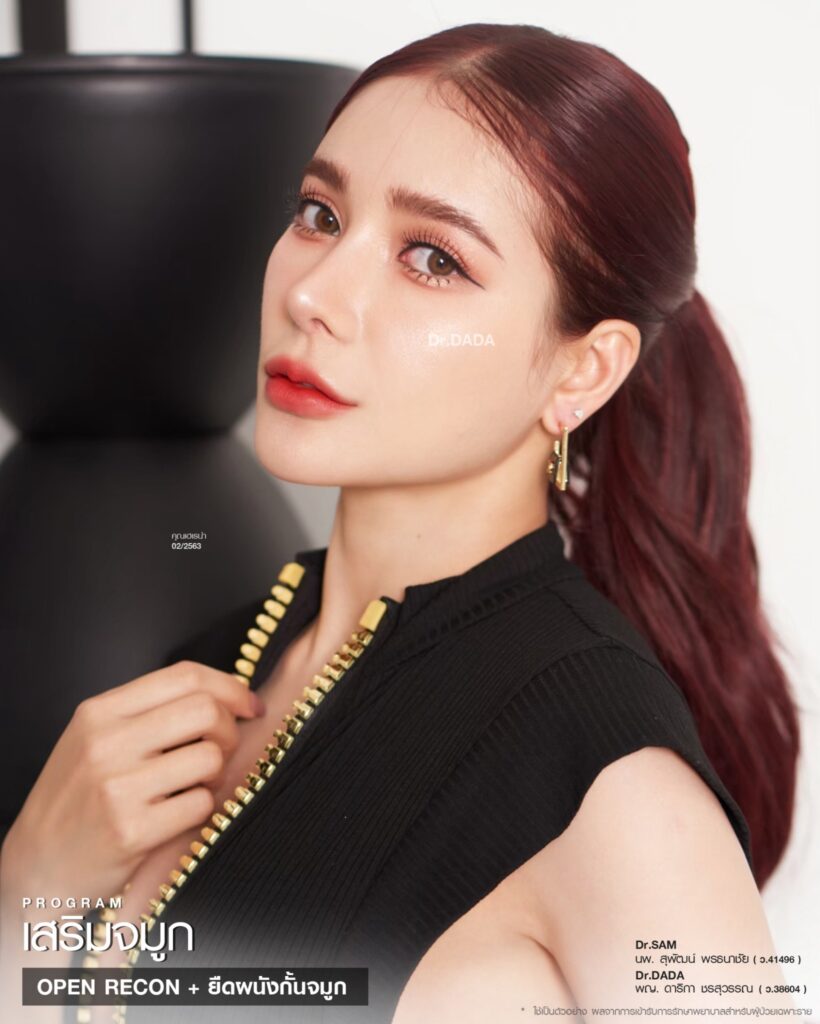 รีวิวเสริมจมูกไม่เท่ากัน_เฮเรน่า_หมอแซม_หมอดาด้า
